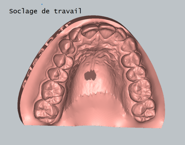 Impression 3D - Soclage empreinte numérique – Image 2