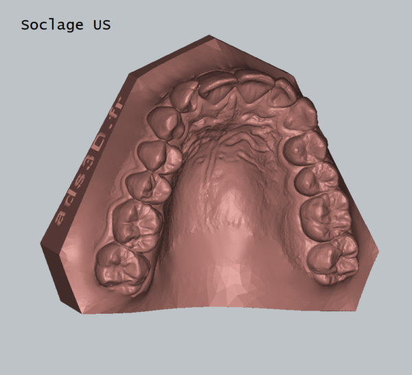 Impression 3D - Soclage empreinte numérique – Image 3