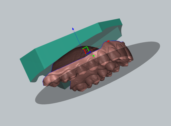 Impression 3D - Soclage empreinte numérique