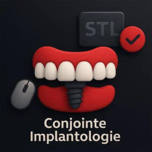 Design Conjointe implantologie