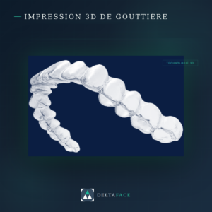 Conception et fabrication de gouttières par impression 3D